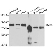 Western blot analysis of extracts of various cell lines, using DGKA antibody (abx006850) at 1/1000 dilution.