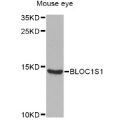 Western blot analysis of extracts of mouse eye, using BLOC1S1 Antibody (abx006855) at 1/1000 dilution.