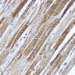 Potassium Voltage-Gated Channel Subfamily D Member 3 (KCND3) Antibody