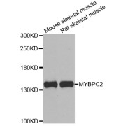 Western blot analysis of extracts of various cell lines, using MYBPC2 antibody (abx006859) at 1/1000 dilution.