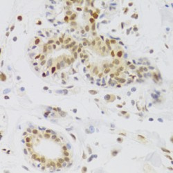 Nuclear Autoantigenic Sperm Protein (NASP) Antibody