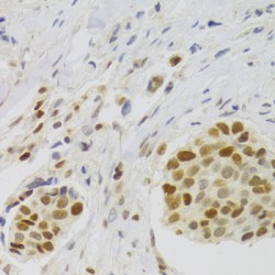 Nuclear Autoantigenic Sperm Protein (NASP) Antibody