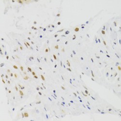 Nuclear Autoantigenic Sperm Protein (NASP) Antibody