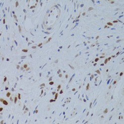 Nuclear Autoantigenic Sperm Protein (NASP) Antibody