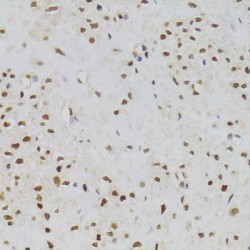 Nuclear Autoantigenic Sperm Protein (NASP) Antibody