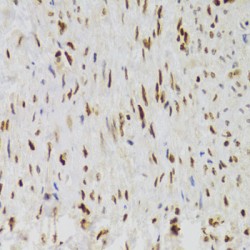 Nuclear Autoantigenic Sperm Protein (NASP) Antibody