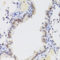 Nuclear Autoantigenic Sperm Protein (NASP) Antibody