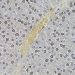 Nuclear Autoantigenic Sperm Protein (NASP) Antibody