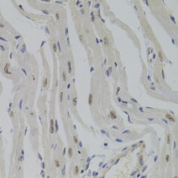 Nuclear Autoantigenic Sperm Protein (NASP) Antibody