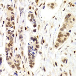 Nuclear Autoantigenic Sperm Protein (NASP) Antibody