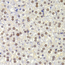 Nuclear Autoantigenic Sperm Protein (NASP) Antibody