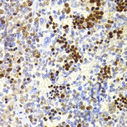 Nuclear Autoantigenic Sperm Protein (NASP) Antibody