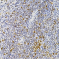 Nuclear Autoantigenic Sperm Protein (NASP) Antibody