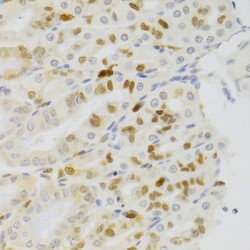 Nuclear Autoantigenic Sperm Protein (NASP) Antibody