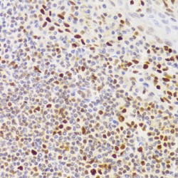 Nuclear Autoantigenic Sperm Protein (NASP) Antibody