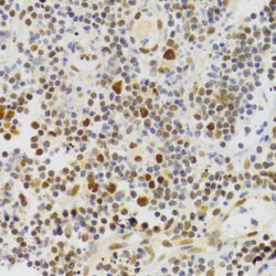 Nuclear Autoantigenic Sperm Protein (NASP) Antibody