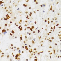 Nuclear Autoantigenic Sperm Protein (NASP) Antibody