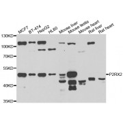 Western blot analysis of extracts of various cell lines, using P2RX2 antibody (abx006888) at 1/1000 dilution.