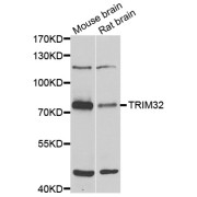 Western blot analysis of extracts of various cell lines, using TRIM32 antibody (abx006889) at 1/1000 dilution.