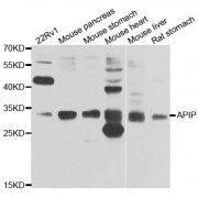 Western blot analysis of extracts of various cell lines, using APIP antibody (abx006896) at 1/1000 dilution.