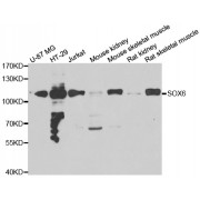 Western blot analysis of extracts of various cell lines, using SOX6 antibody (abx006898) at 1/1000 dilution.