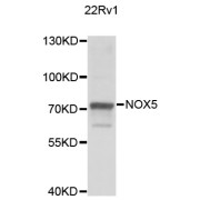 Western blot analysis of extracts of 22Rv1 cells, using NOX5 antibody (abx006902) at 1/1000 dilution.