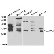 Western blot analysis of extracts of various cell lines, using IL22RA2 antibody (abx006904) at 1/1000 dilution.