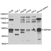 Western blot analysis of extracts of various cell lines, using ADPGK antibody (abx006906) at 1/1000 dilution.