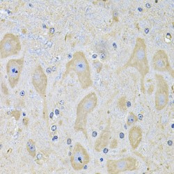 EPH Receptor A2 (EPHA2) Antibody