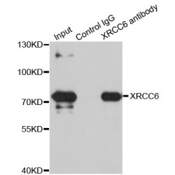 X-Ray Repair Cross Complementing 6 (XRCC6) Antibody