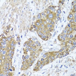 Peroxisomal Biogenesis Factor 14 (PEX14) Antibody