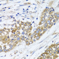 Peroxisomal Biogenesis Factor 14 (PEX14) Antibody