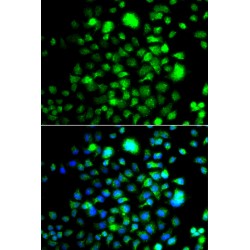 Peroxisomal Biogenesis Factor 14 (PEX14) Antibody