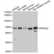 Western blot analysis of extracts of various cell lines, using PRKAA2 antibody (abx006920) at 1/1000 dilution.