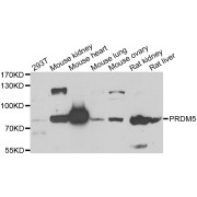 Western blot analysis of extracts of various cell lines, using PRDM5 antibody (abx006928) at 1/1000 dilution.