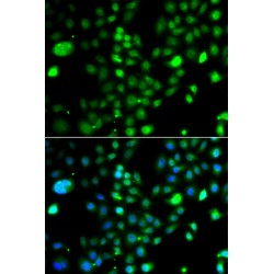 PR Domain Zinc Finger Protein 5 (PRDM5) Antibody