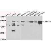 Western blot analysis of extracts of various cell lines, using CAMK1G antibody (abx006934) at 1/1000 dilution.