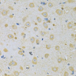 Calcium/calmodulin Dependent Protein Kinase IG (CAMK1G) Antibody