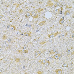 Calcium/calmodulin Dependent Protein Kinase IG (CAMK1G) Antibody