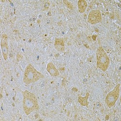 Calcium/calmodulin Dependent Protein Kinase IG (CAMK1G) Antibody