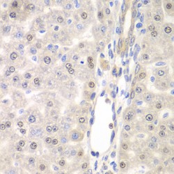 Probable E3 Ubiquitin-Protein Ligase DTX2 (DTX2) Antibody