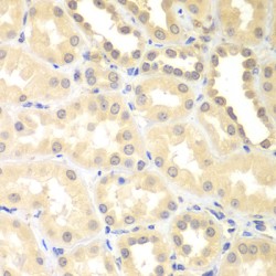 Probable E3 Ubiquitin-Protein Ligase DTX2 (DTX2) Antibody