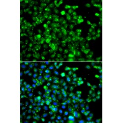 Calpain-5 (CAPN5) Antibody