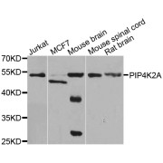 Western blot analysis of extracts of various cell lines, using PIP4K2A antibody (abx006958) at 1/1000 dilution.