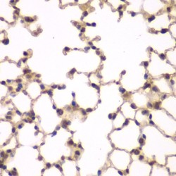 Phosphatidylinositol-5-Phosphate 4-Kinase Type 2 Alpha (PIP4K2A) Antibody