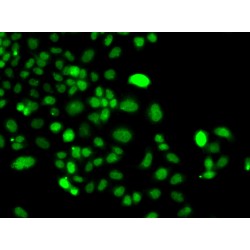 Phosphatidylinositol-5-Phosphate 4-Kinase Type 2 Alpha (PIP4K2A) Antibody