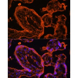 LIM Domain Binding Protein 3 (LDB3) Antibody