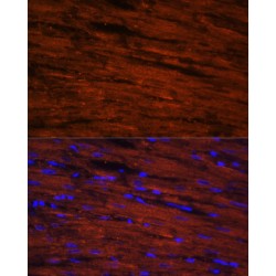 LIM Domain Binding Protein 3 (LDB3) Antibody