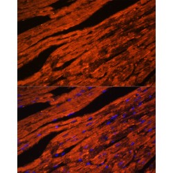 LIM Domain Binding Protein 3 (LDB3) Antibody