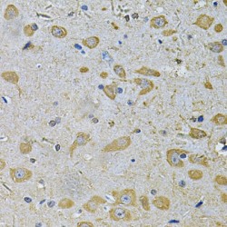 Disheveled Associated Activator of Morphogenesis 2 (DAAM2) Antibody